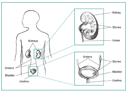 urinary tract diagram